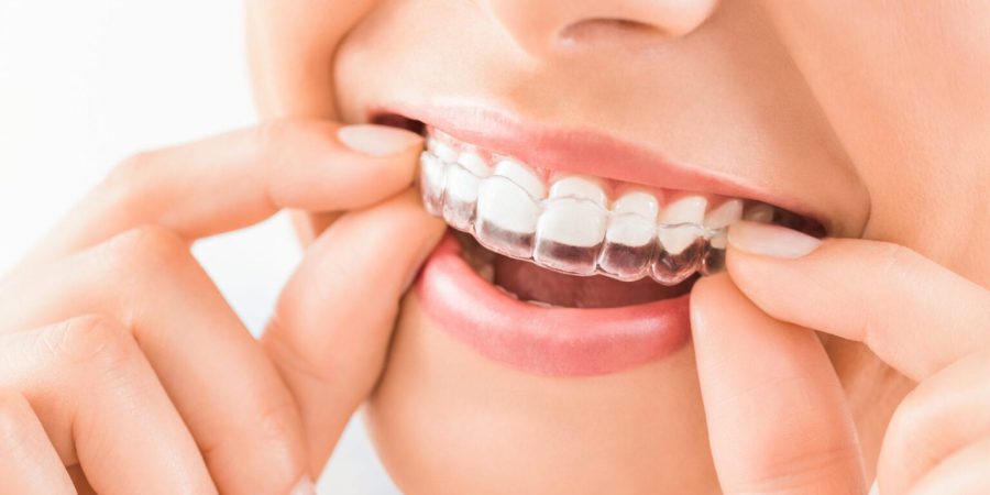 Overcoming Teeth Grinding